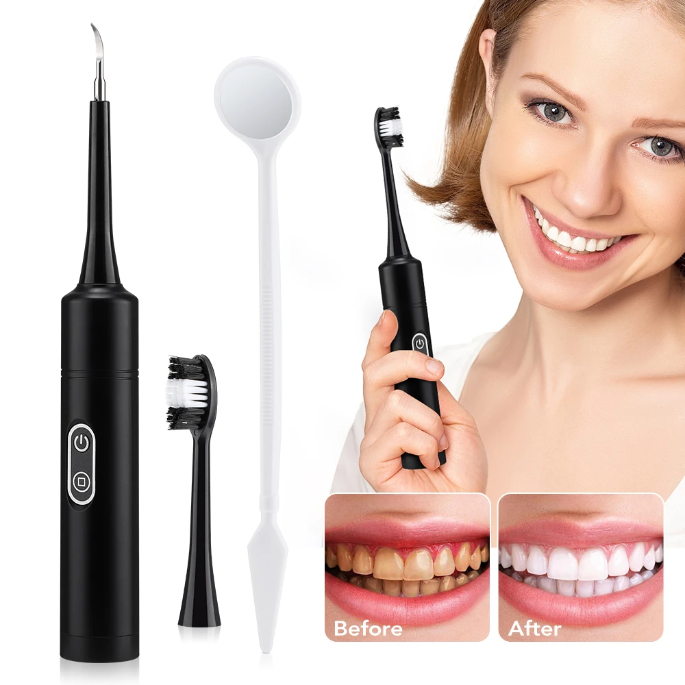 Electric Dental Scaler Teeth S - Teeth Whitening And Stain Removal review and price