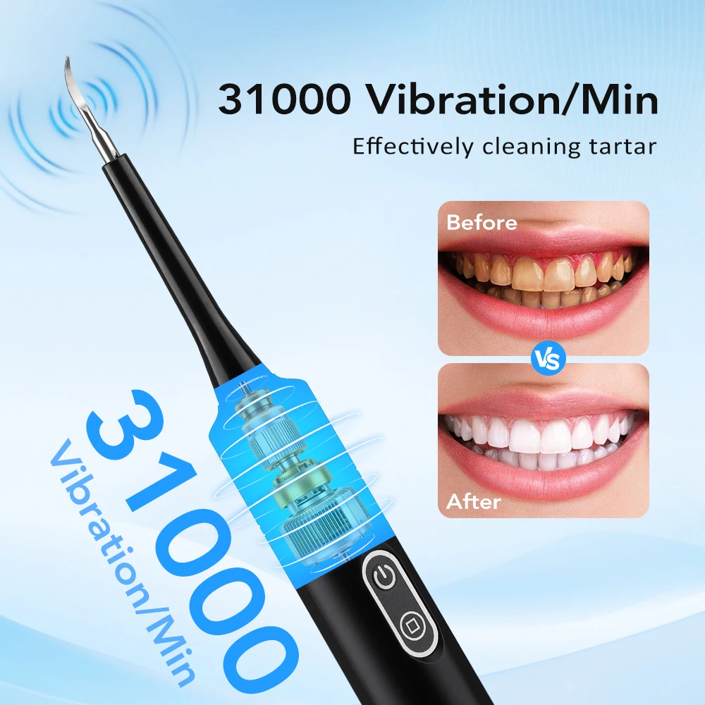 Electric Dental Scaler Teeth S - Teeth Whitening And Stain Removal review and price