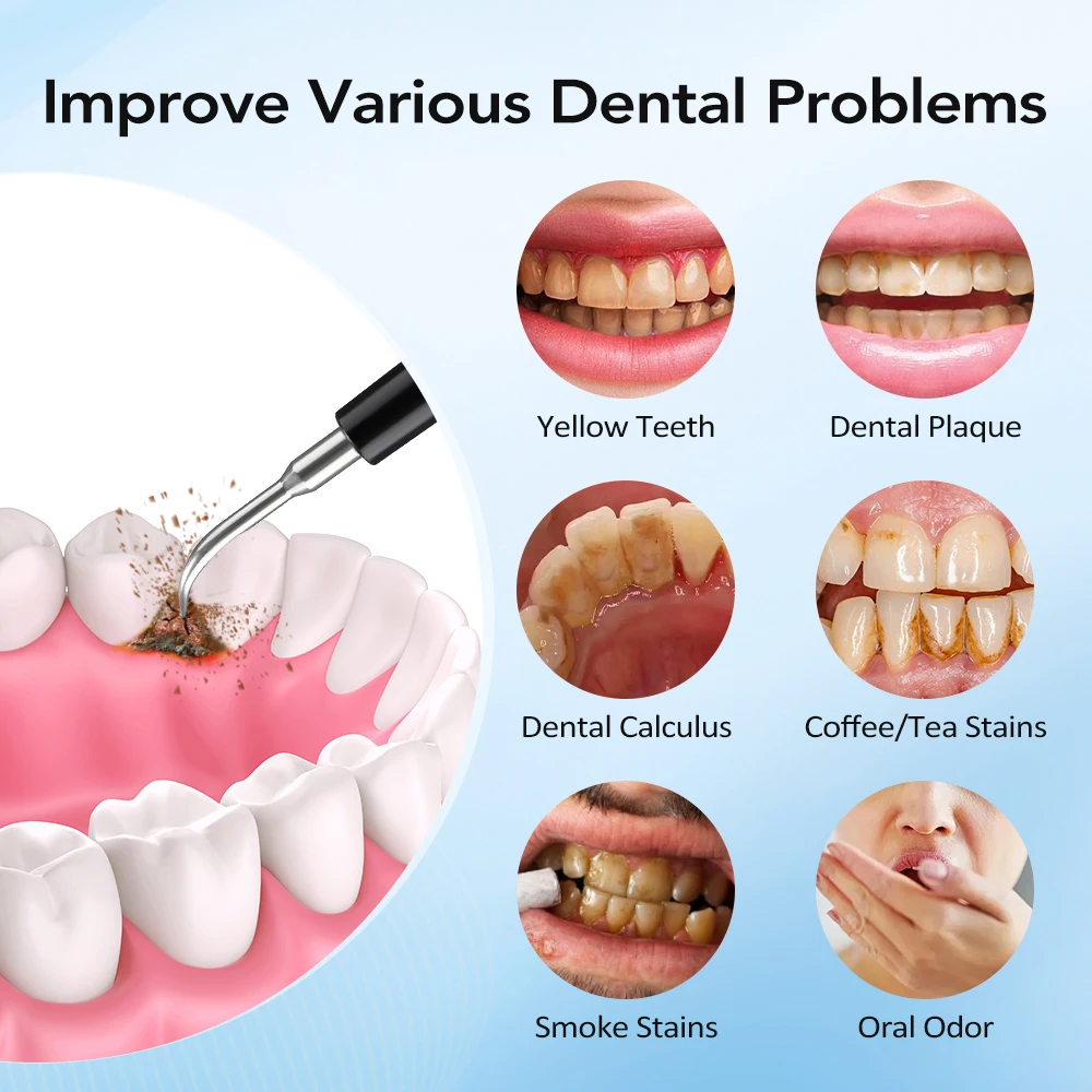 Electric Dental Scaler Teeth S - Teeth Whitening And Stain Removal review and price