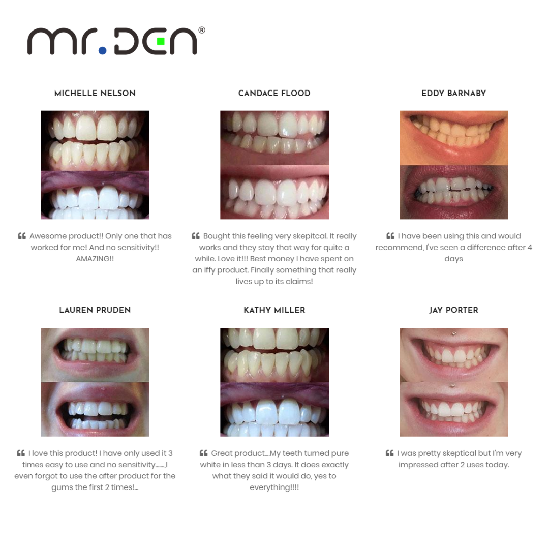 Dr. Whiten 3 Pack Teeth Whiten - Teeth Whitening Professional review and price
