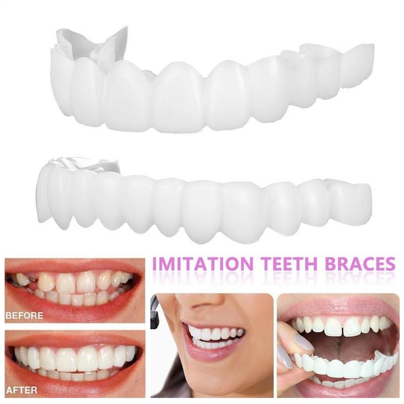 Snap On Teeth Veneers Instant  - Teeth Whitening Instant review and price