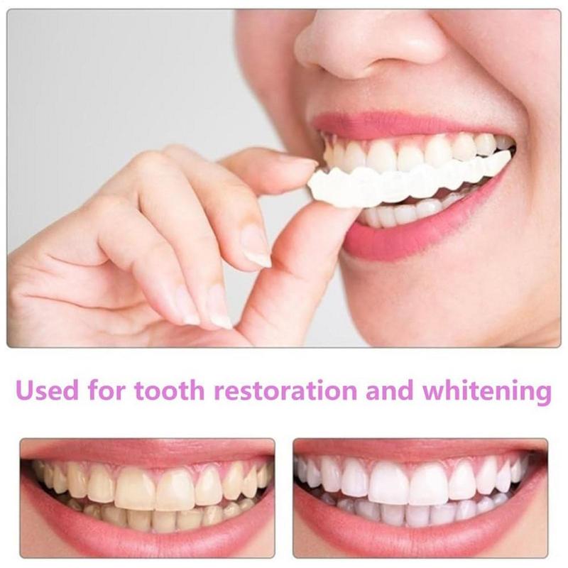 Snap On Teeth Veneers Instant  - Teeth Whitening Instant review and price