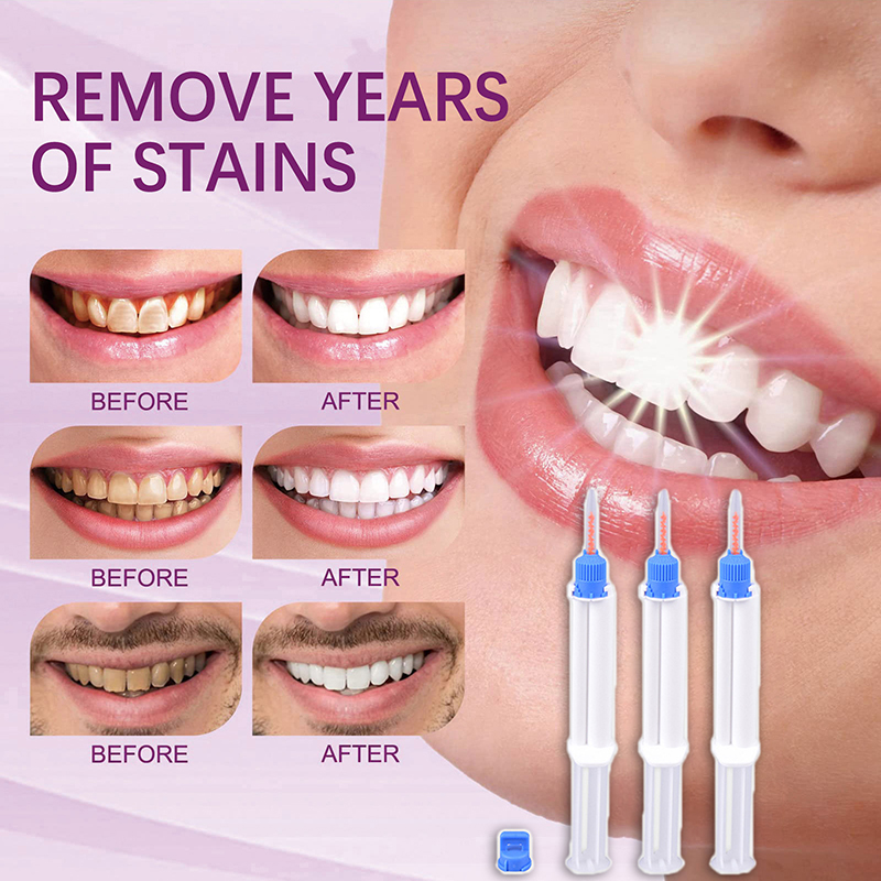 Dental Clinic Dual Barrier Syr - Teeth Whitening Gel Syringes review and price