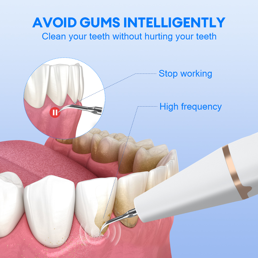 Ultrasonic Teeth Tartar Cleane - Teeth Whitening And Stain Removal review and price
