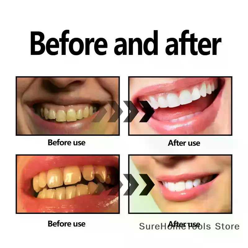 Bamboo Charcoal Powder For Tee - Teeth Whitening Instant review and price
