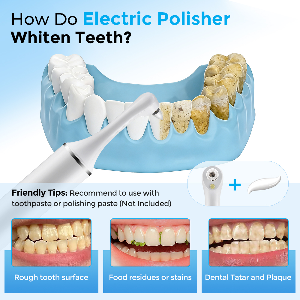 Electric Tooth Polisher Teeth  - Teeth Whitening Led review and price