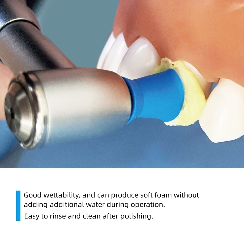 40g/Tube Dental Tooth Polishin - Teeth Whitening Professional review and price