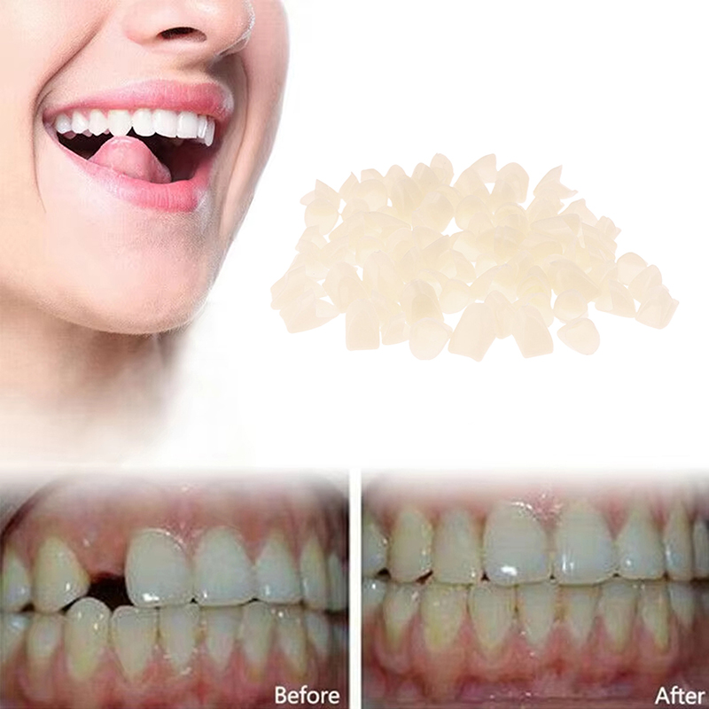 Instant Perfect Smile Temporar - Teeth Whitening Instant review and price