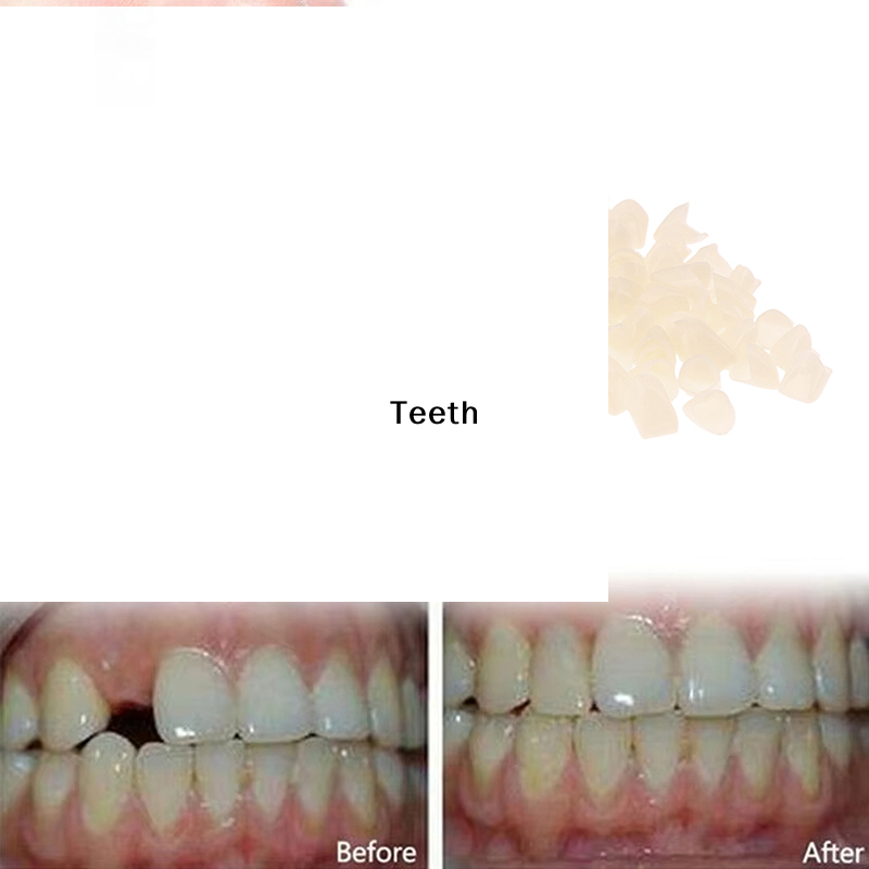 Instant Perfect Smile Temporar - Teeth Whitening Instant review and price