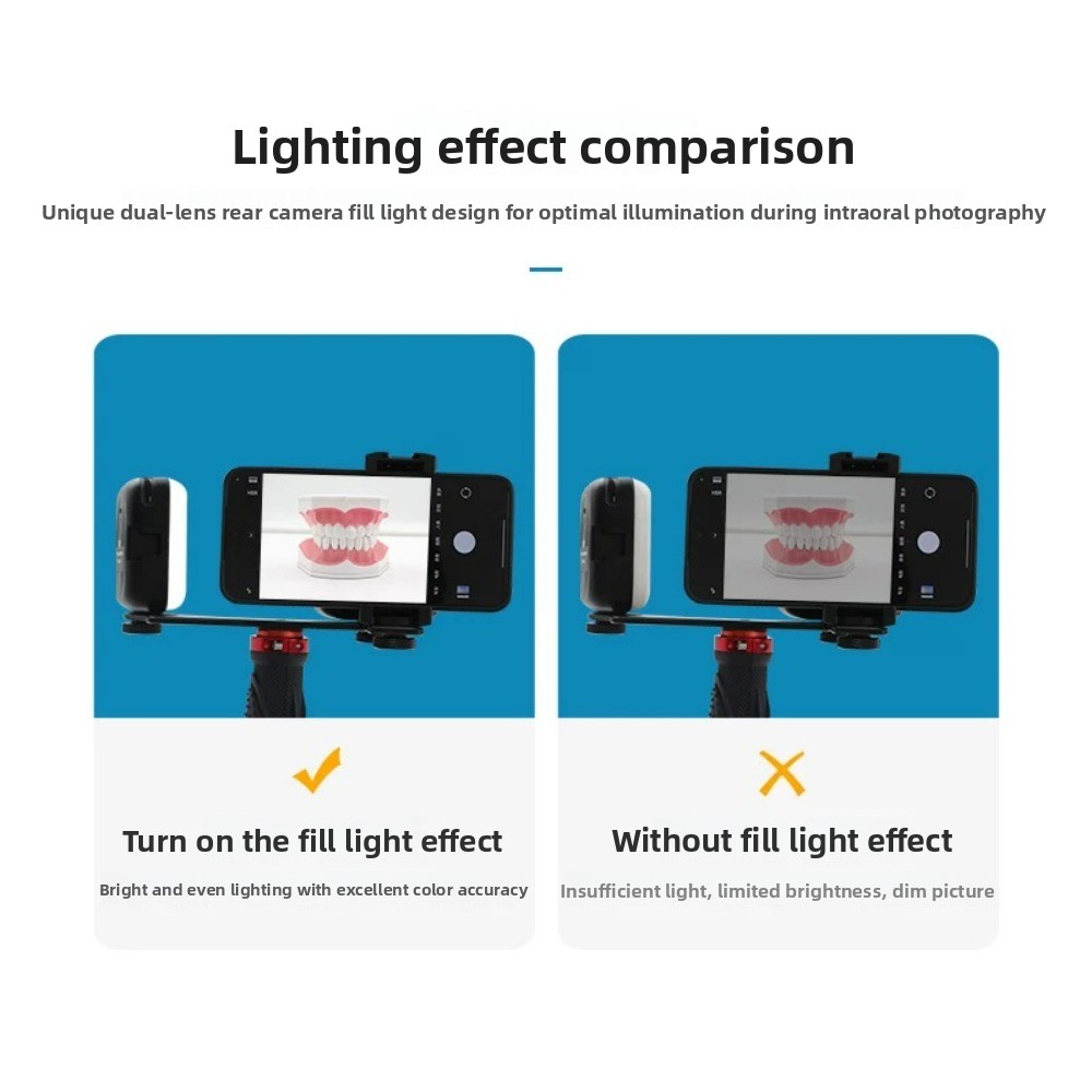 Dental Photography Light, Blue - Teeth Whitening Led review and price