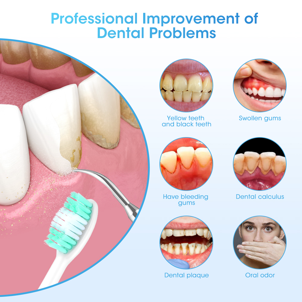 Electric Teeth Cleaner Sonic D - Teeth Whitening And Stain Removal review and price
