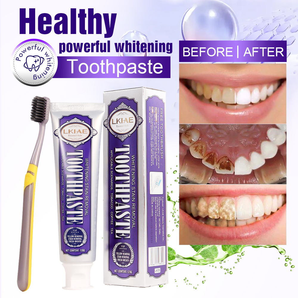 LKIAE White Teeth Whitening To - Teeth Whitening And Stain Removal review and price